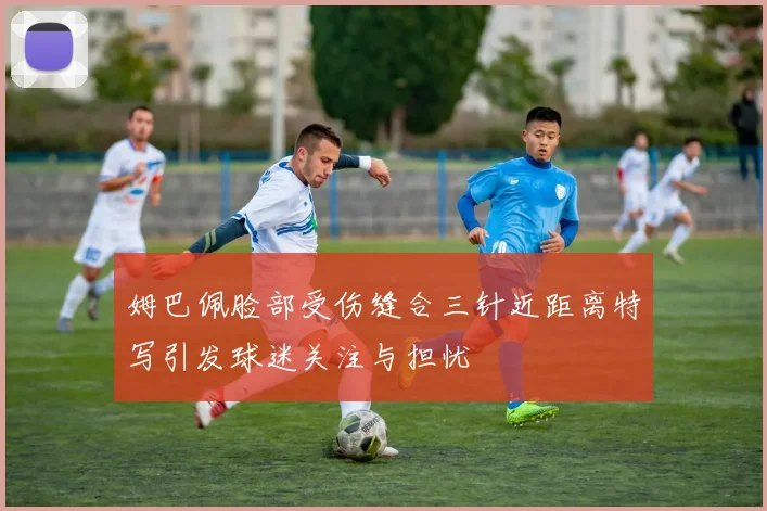 姆巴佩脸部受伤缝合三针近距离特写引发球迷关注与担忧
